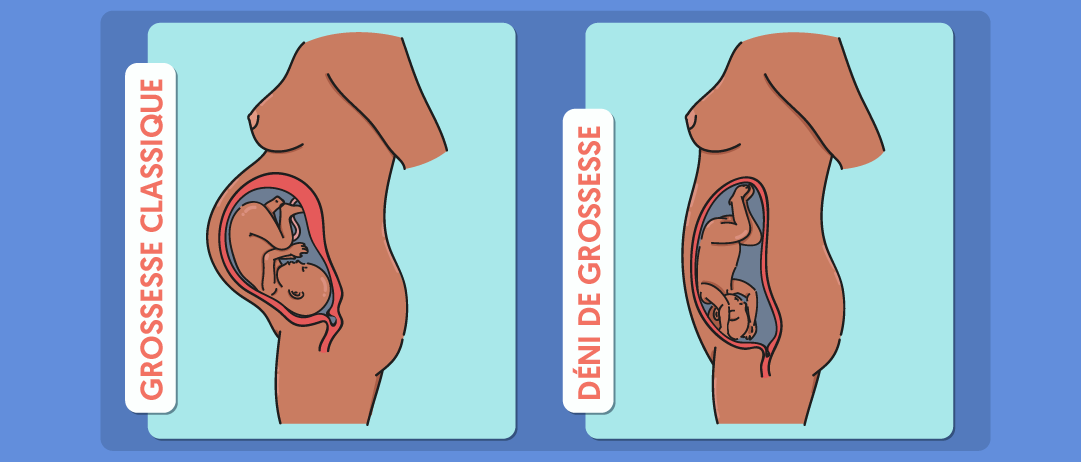 Suis Je En Train De Faire Un Deni De Grossesse Kinews Suis Je En Train De Faire Un Deni De Grossesse Kinews